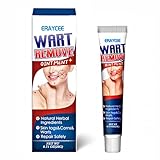 Warzenentfernungscreme 20 Gramm, geeignet zur Warzenentfernung, bei gewöhnlichen Warzen und flachen Warzen an Hand- und Fußsohlen, sanft und sicher (Blau)