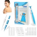 Warzenentferner,Skin Tag Remover Kit 2 in 1 für Micro Bis Large (2 mm-8 mm),Sicher und Schmerzlos,Schmerzfrei Stielwarzen Entfernungsgerät Sicher für die Meisten Körperteile