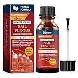 Nagelpilz Nagellack, Nagellack gegen Nagelpilz für Fingernägel und Fußnägel, Schutz & Stärkung Brüchiger Nägel, Spendet Feuchtigkeit Trockener Nagelhaut, 30ml